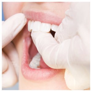 Nordahl Dental - San Marcos Dentist - san marcos,cosmetic dentist