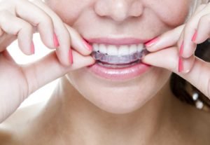Nordahl Dental - San Marcos Dentist - teeth whitening,dentist,san marcos